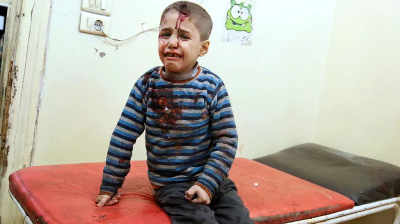 Syrský chlapec v jedné z polních nemocnic v Aleppu