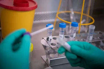 Fond Neuron ocenil virologa Cihláře a epidemiologa Rašku