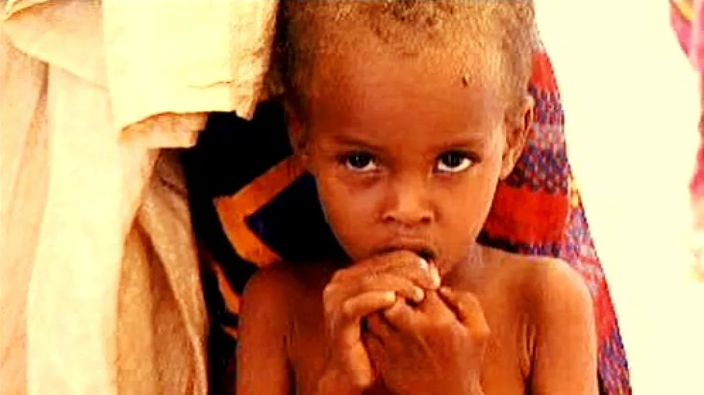 Somálské dítě