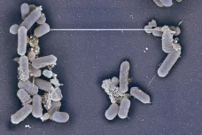 Čeští a slovenští vědci popsali, jak umírají bakterie. Vystřelují nanotrubičky