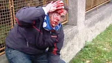 Zraněný fotbalový fanoušek