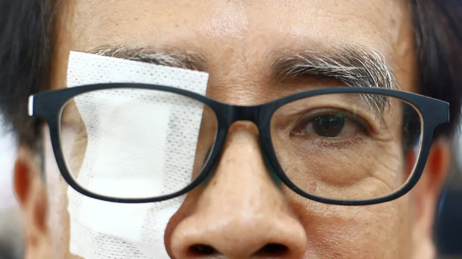 Hongkongský protestující upozorňuje na násilí ze strany policistů
