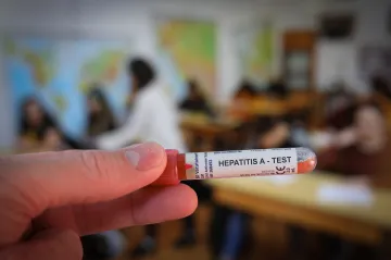Případů žloutenky A je letos nejvíc za patnáct let