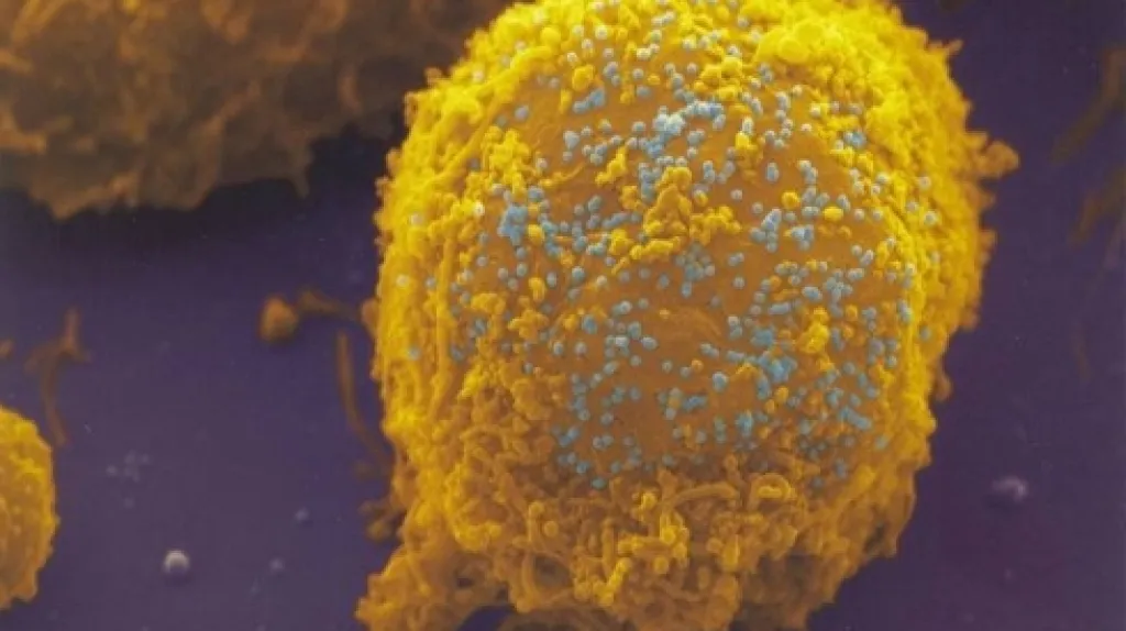 Virus HIV