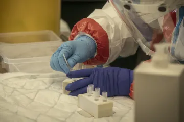 Reprodukční číslo po šesti dnech kleslo, rizikové skóre je na 75 bodech 