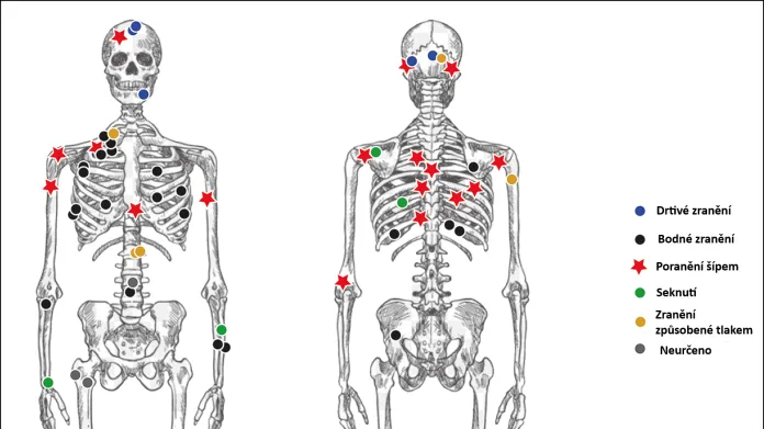 Poranění nalezená na tělech mrtvých u Tollense - zobrazená na jedné kostře