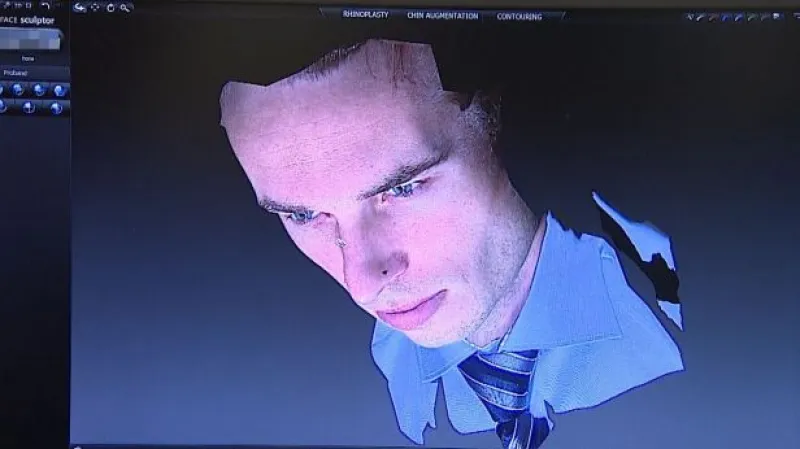 NO COMMENT: Skenování si vyzkoušel i redaktor ČT Filip Zdražil