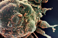Viry se dokáží přichytit na mikroplastech. Díky tomu přežijí déle