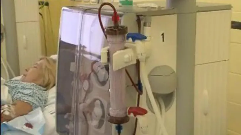 Doktor Jan Svojanovský vysvětluje jak funguje dialýza