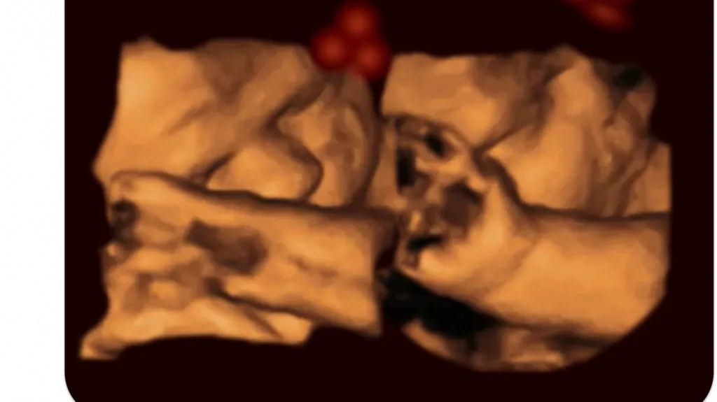 Dítě v děloze