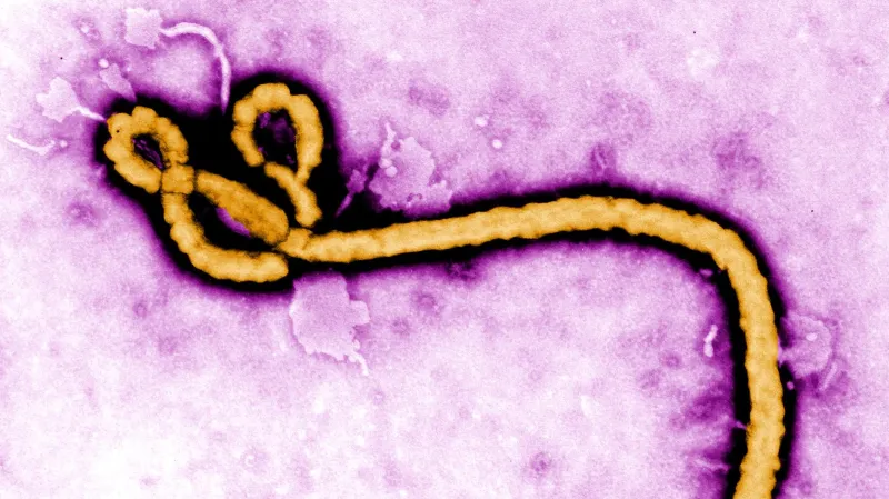 Virus ebola
