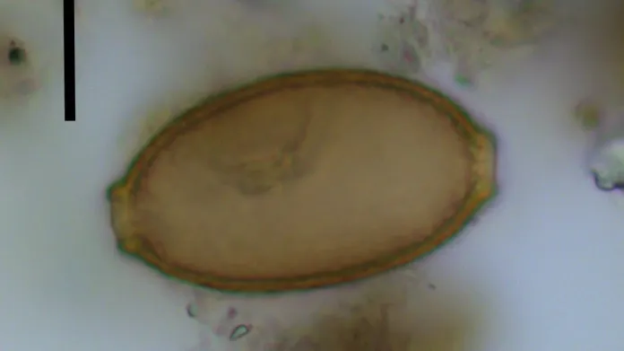 Vajíčko hlístice z čeledi Capillaria