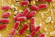 Dvanáct bakterií, které představují pro lidstvo největší riziko. Seznam zveřejnila WHO