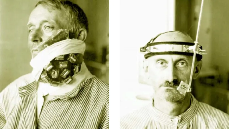 Léčba pacientů na konci 30. let 20. století