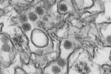 Ochrana před infekcí jako zika? Jedině nelétat do rizikových zemí