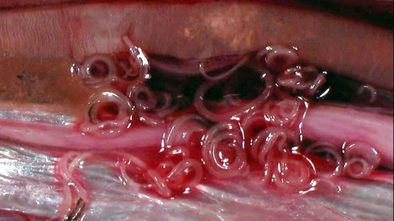 Anisakis simplex