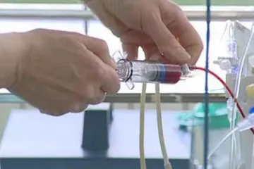 Vědci v Brně budou zkoumat sepsi. Chtějí naučit umělou inteligenci předpovědět rozvoj a následky