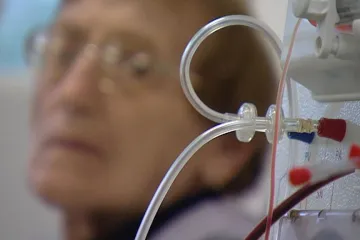 Dialýza se neustále vylepšuje. Pravidelně ji potřebují tisíce lidí