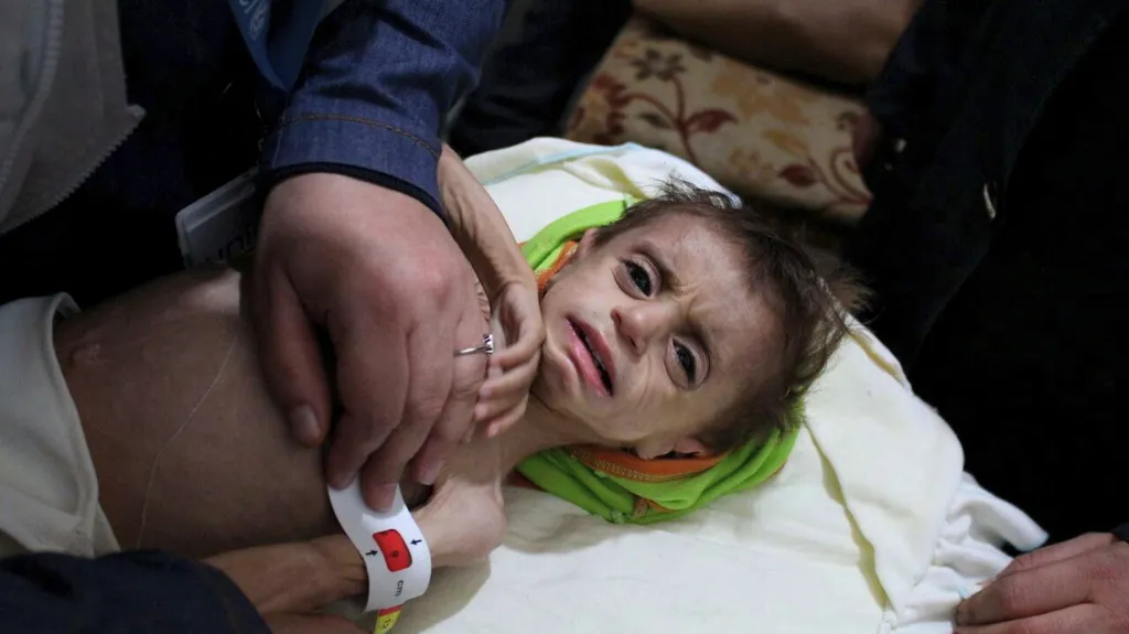 Dítě evakuované ze syrské Ghúty