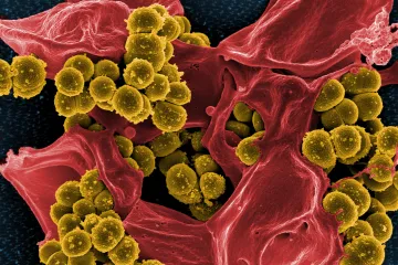 Izraelští biochemici vyvinuli molekulární pinzetu. Je to zbraň proti bakteriím, které mohou medicínu vrátit do středověku