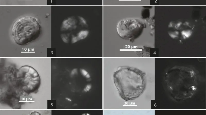 Rostlinné zbytky nalezené v nádobách – pozorované pod mikroskopem