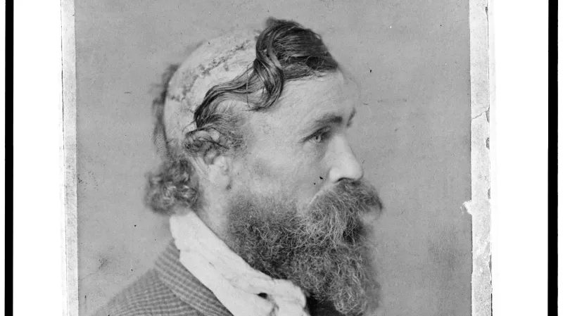 Přestože byl Robert McGee skalpován roku 1864 jako jinoch, násilí přežil, jizvy se zhojily a byl v dospělosti kolem roku 1890 vyfocen v ateliéru E. E. Henryho.