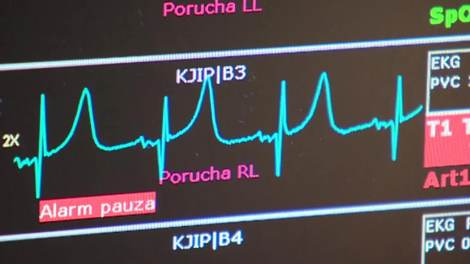 Zobrazení činnosti srdce