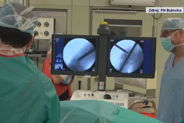 Nová léčba pro děti s poruchou růstu. Ortopedi prodlouží kosti voperovaným hřebem