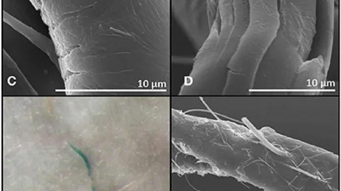 Ukázky mikroplastů nalezených v rybách
