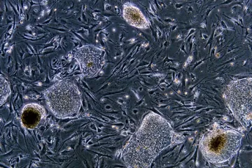 Soud EU zakázal přijímat patenty předpokládající ničení embrya