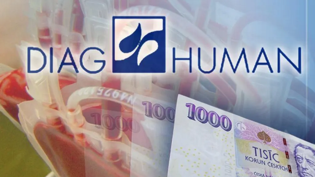 Kauza Diag Human