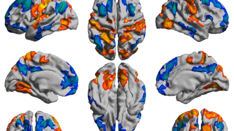 Aktivní oblasti mozku pod vlivem ayahuascy