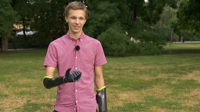 Jan Kříž má bionické ruce rok a půl
