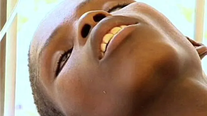 Zimbabwe se potýká s epidemií cholery