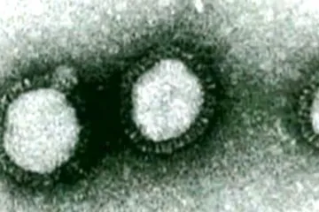 Laboratoř karvinské nemocnice potvrdila výskyt prasečí chřipky