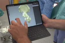 Lékaři v Ústí nad Labem voperovali pacientovi část pánve vytvořené 3D tiskárnou