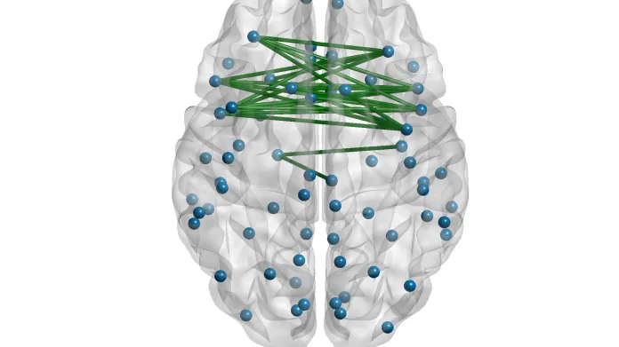 Propojení mezi mozkovými hemsférami