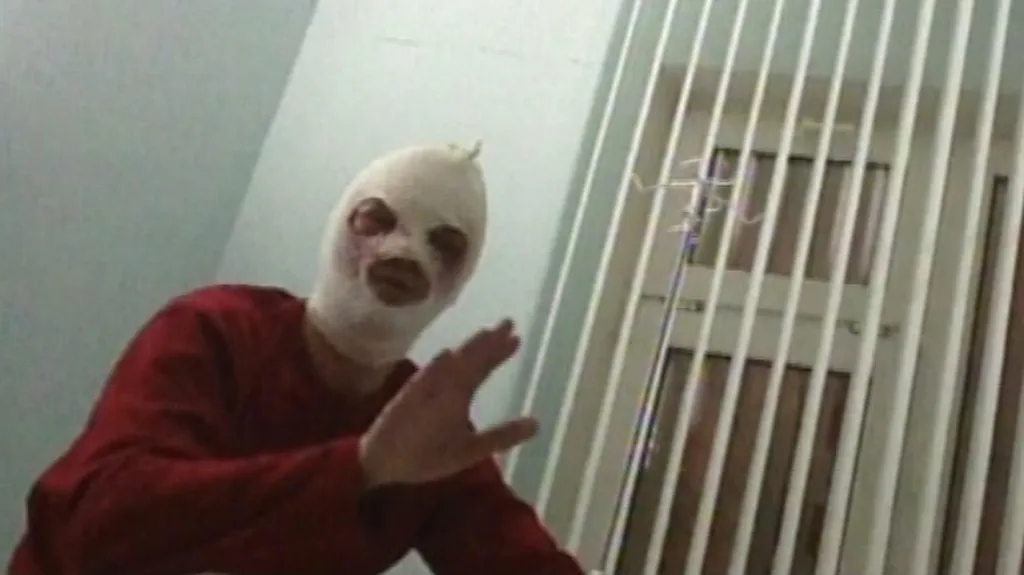 Sergej Filin po útoku kyselinou