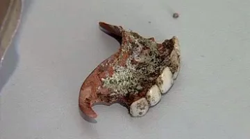 Kaučuková zubní protéza