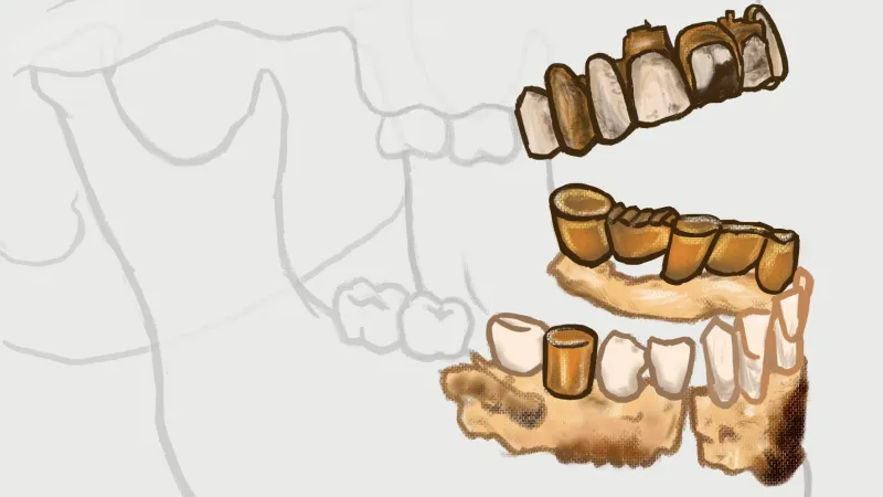 Dochované části Hitlerova chrupu