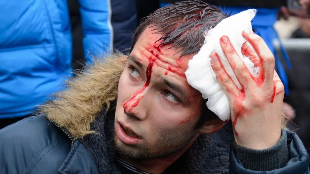 Zraněný aktivista v Charkově
