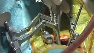 Ortopedická operace