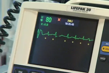 Vznikají první centra sportovní kardiologie. Mají zabránit zbytečné smrti sportovců