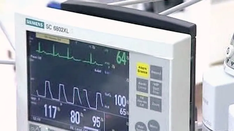 Monitor životních funkcí