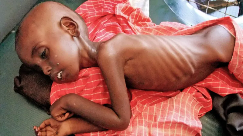 Hladomor v Somálsku