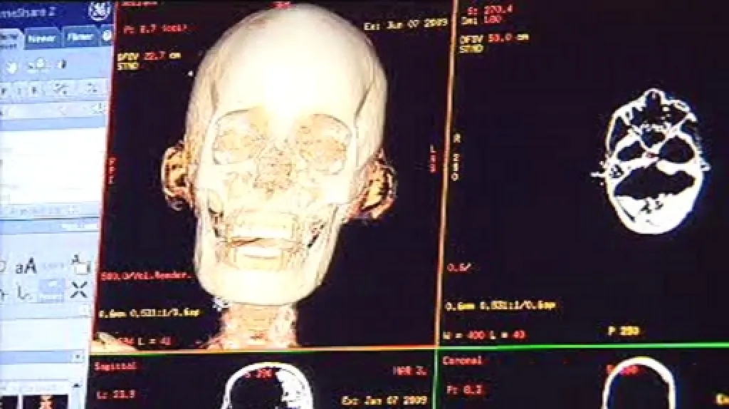 Výzkum egyptských mumií pomocí CT