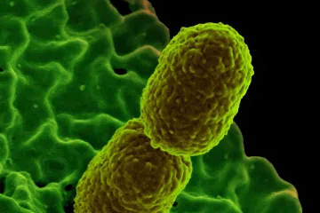 Vědci z Brna a USA odhalili slabinu bakterií, která může pomoci s léčbou infekcí