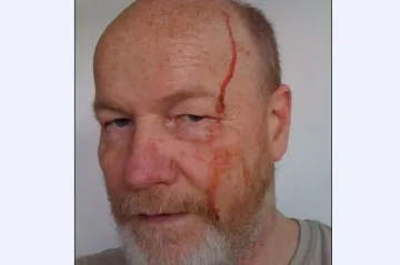 Oznámení na neznámého pachatele