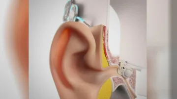 Model kochleárního implantátu