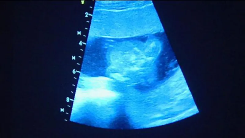 Telefonát Igora Lukeše